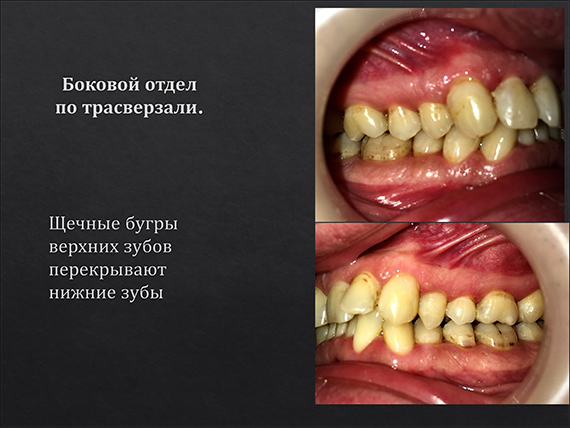 prezent_10