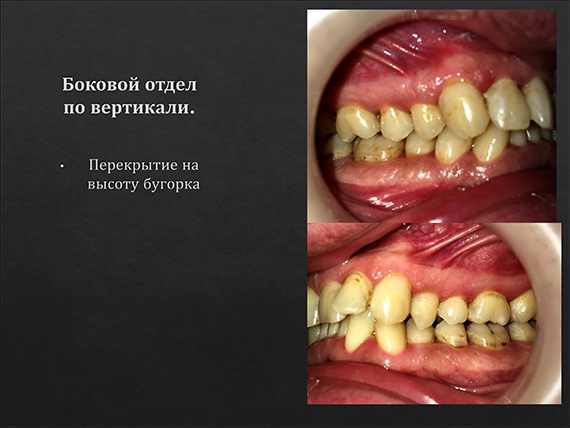 prezent_11