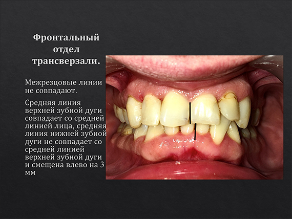 prezent_13