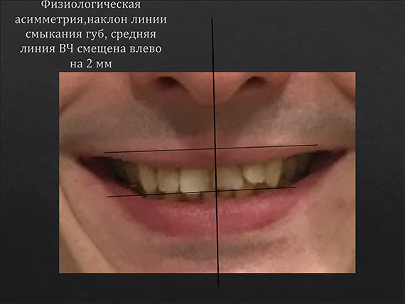 prezent_6